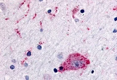 Anti-CCR1 antibody used in IHC (Paraffin sections) (IHC-P). GTX70509