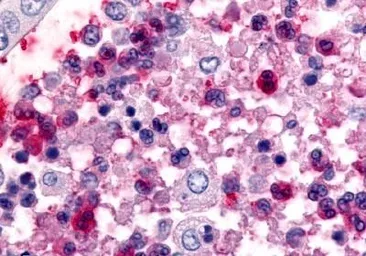 Anti-CCR1 antibody used in IHC (Paraffin sections) (IHC-P). GTX70509
