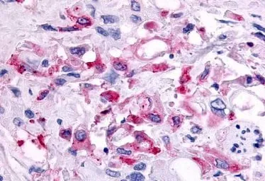 Anti-CCR1 antibody used in IHC (Paraffin sections) (IHC-P). GTX70509