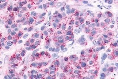 Anti-AVPR2 antibody used in IHC (Paraffin sections) (IHC-P). GTX70835