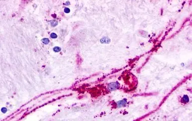 Anti-GPR84 antibody used in IHC (Paraffin sections) (IHC-P). GTX70841