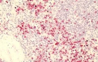 Anti-GPR84 antibody used in IHC (Paraffin sections) (IHC-P). GTX70841