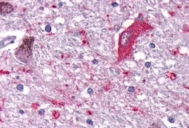 Anti-DUSP26 antibody used in IHC (Paraffin sections) (IHC-P). GTX70939