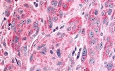 Anti-PTPRE antibody used in IHC (Paraffin sections) (IHC-P). GTX70949