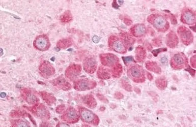 Anti-MAP4K6 antibody used in IHC (Paraffin sections) (IHC-P). GTX70987