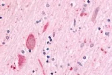 Anti-MAP4K6 antibody used in IHC (Paraffin sections) (IHC-P). GTX70987