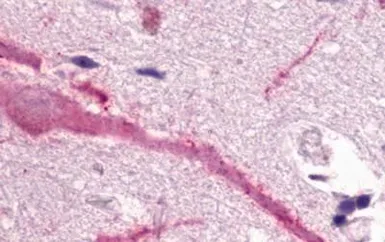 Anti-GPCR150 antibody used in IHC (Paraffin sections) (IHC-P). GTX71087