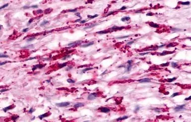 Anti-GPCR150 antibody used in IHC (Paraffin sections) (IHC-P). GTX71087