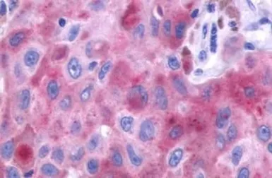 Anti-PTGFR antibody used in IHC (Paraffin sections) (IHC-P). GTX71099