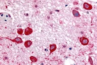Anti-mAChR M2 antibody used in IHC (Paraffin sections) (IHC-P). GTX71169