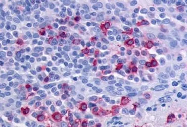 Anti-CCR6 antibody used in IHC (Paraffin sections) (IHC-P). GTX71397