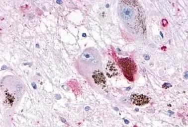 Anti-OR10R2 antibody used in IHC (Paraffin sections) (IHC-P). GTX71527