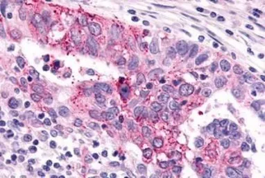 Anti-mGluR6 antibody used in IHC (Paraffin sections) (IHC-P). GTX71531