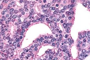Anti-mGluR6 antibody used in IHC (Paraffin sections) (IHC-P). GTX71531