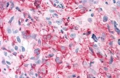 Anti-TAS1R3 antibody used in IHC (Paraffin sections) (IHC-P). GTX71575