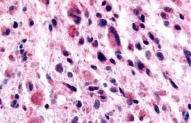Anti-GABA B Receptor 1 antibody used in IHC (Paraffin sections) (IHC-P). GTX71591