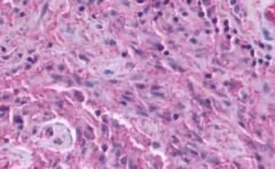 Anti-TM7SF1/GPR137B antibody used in IHC (Paraffin sections) (IHC-P). GTX71671