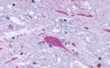 Anti-TM7SF1/GPR137B antibody used in IHC (Paraffin sections) (IHC-P). GTX71671