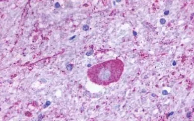 Anti-TM7SF1/GPR137B antibody used in IHC (Paraffin sections) (IHC-P). GTX71671