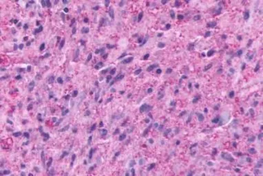 Anti-TM7SF1/GPR137B antibody used in IHC (Paraffin sections) (IHC-P). GTX71671