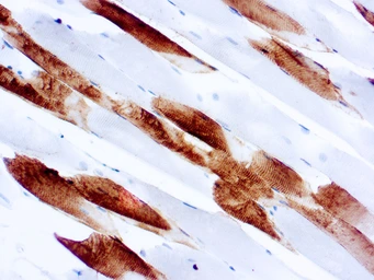Anti-Myosin skeletal fast antibody [MY32] (ready-to-use) used in IHC (Paraffin sections) (IHC-P). GTX73432