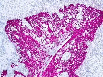 Anti-HMW Cytokeratin antibody [34βE12] (ready-to-use) used in IHC (Paraffin sections) (IHC-P). GTX73466