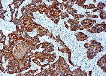 Anti-basic Cytokeratin antibody [AE3] used in IHC (Paraffin sections) (IHC-P). GTX73566