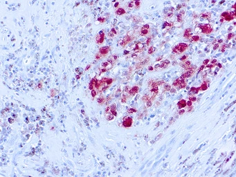 Anti-S100 antibody [SH-B1] (ready-to-use) used in IHC (Paraffin sections) (IHC-P). GTX73589