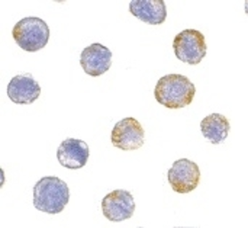 Anti-GDNF Receptor alpha 2 antibody used in Immunocytochemistry/ Immunofluorescence (ICC/IF). GTX74268