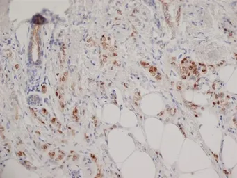 Anti-Progesterone Receptor antibody [1A6] used in IHC (Paraffin sections) (IHC-P). GTX75363