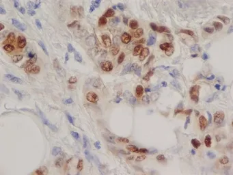 Anti-Progesterone Receptor antibody [1A6] used in IHC (Paraffin sections) (IHC-P). GTX75363