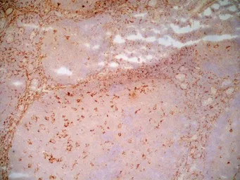 Anti-LRP1 antibody [A2Mr alpha-2] used in IHC (Frozen sections) (IHC-Fr). GTX75658