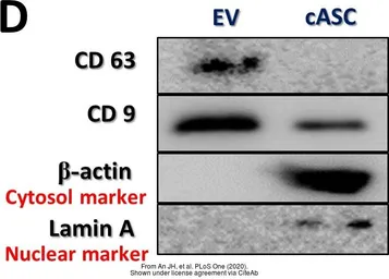 Anti-CD9 antibody [MM2/57] used in Western Blot (WB). GTX76185