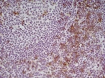 Anti-CD8 alpha antibody [KT15] used in IHC (Frozen sections) (IHC-Fr). GTX76351