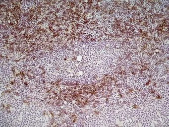 Anti-CD8 alpha antibody [KT15] used in IHC (Frozen sections) (IHC-Fr). GTX76351