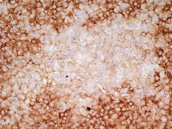 Anti-CD36 antibody [SMØ] used in IHC (Frozen sections) (IHC-Fr). GTX76435