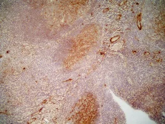 Anti-CD36 antibody [SMØ] (Azide free) used in IHC (Frozen sections) (IHC-Fr). GTX76436