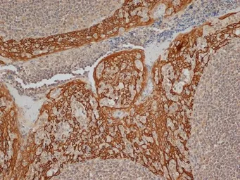 Anti-Cytokeratin 14 antibody [LL002] used in IHC (Paraffin sections) (IHC-P). GTX76603