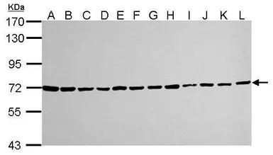 Anti-Ku70 antibody [529] used in Western Blot (WB). GTX77607