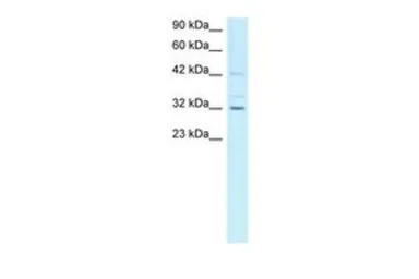Anti-Cyclin H antibody, C-term used in Western Blot (WB). GTX77667