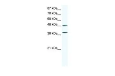 Anti-p38 MAPK antibody, C-term used in Western Blot (WB). GTX77721