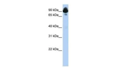 Anti-RGS3 antibody, C-term used in Western Blot (WB). GTX77726