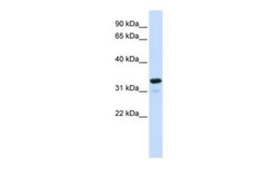 Anti-IKB alpha antibody, Internal used in Western Blot (WB). GTX77737