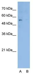 Anti-ERG antibody, Internal used in Western Blot (WB). GTX77743