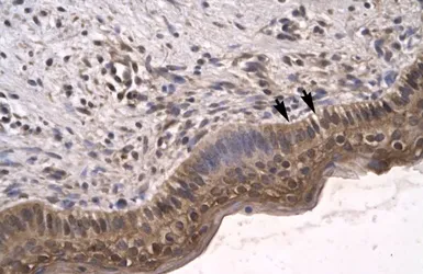 Anti-SIRT5 antibody, C-term used in IHC (Paraffin sections) (IHC-P). GTX77826