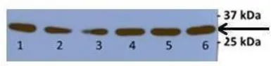 Anti-mtTFA antibody, N-term used in Western Blot (WB). GTX77852
