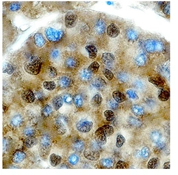 Anti-PIT1 antibody, C-term used in IHC (Paraffin sections) (IHC-P). GTX77853