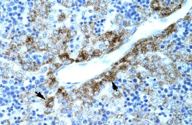 Anti-Embryonic Lung Protein antibody, N-term used in IHC (Paraffin sections) (IHC-P). GTX77854