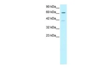 Anti-NCOA62 antibody, N-term used in Western Blot (WB). GTX77874
