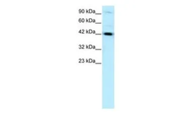 Anti-HNF1 beta antibody, N-term used in Western Blot (WB). GTX77876